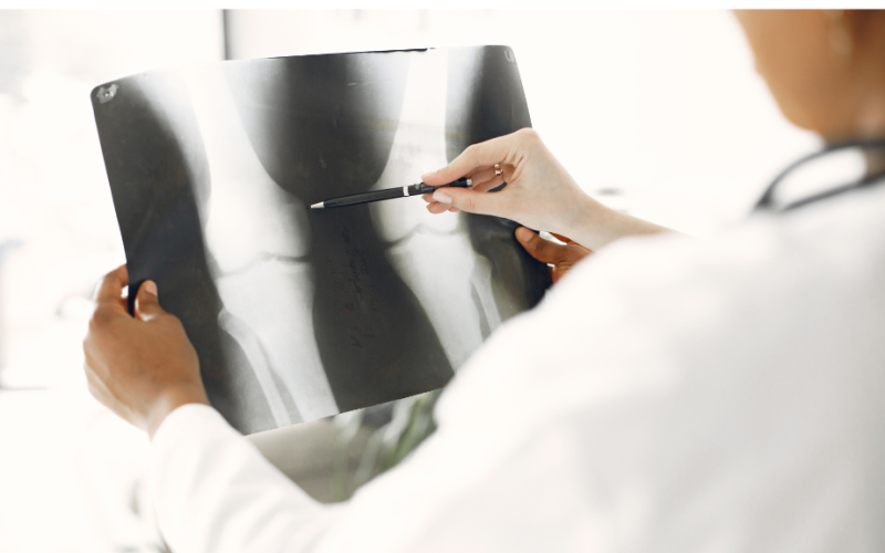 Doctors reviewing a chart of bone joints
