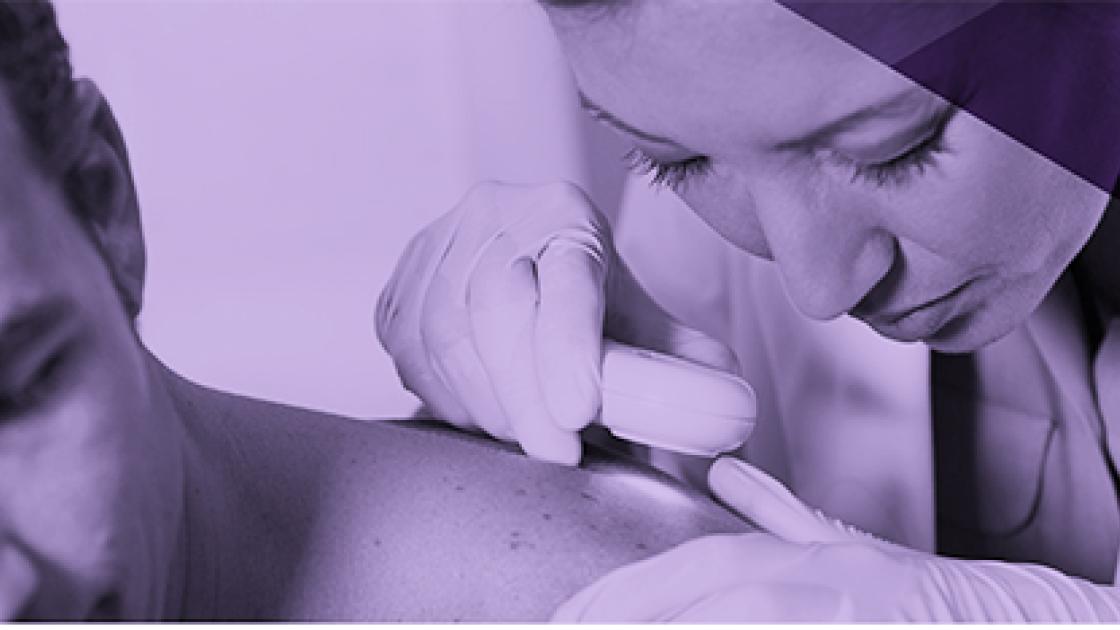 Skin cancer screening
