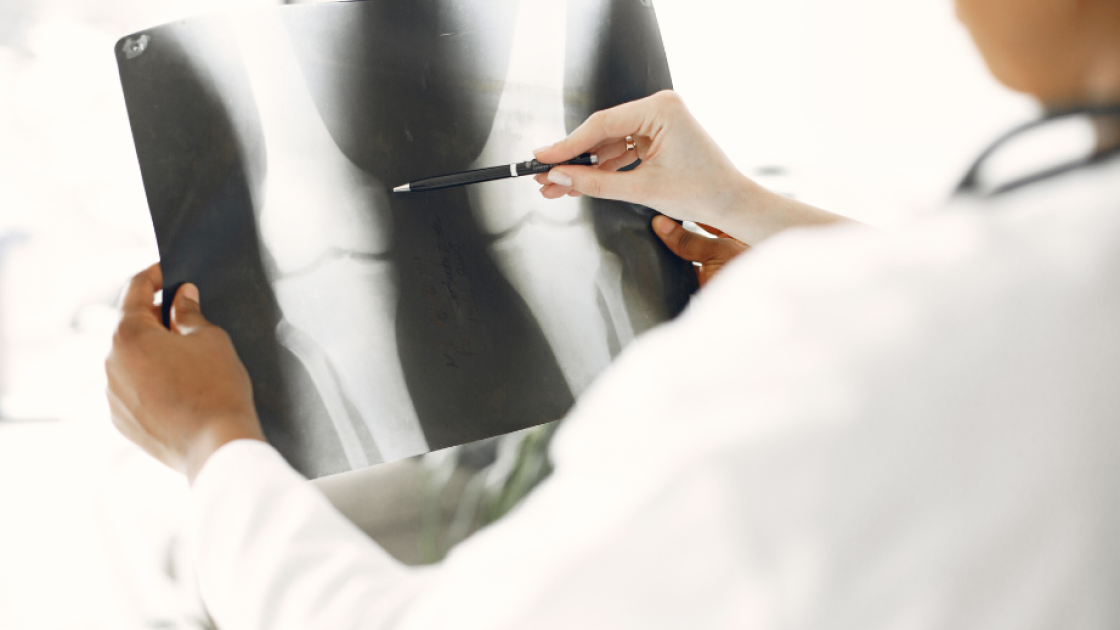 Doctors reviewing a chart of bone joints