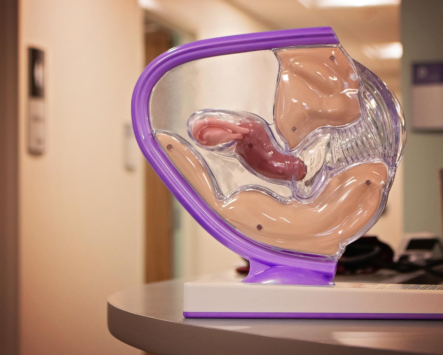 Plastic Uterus 