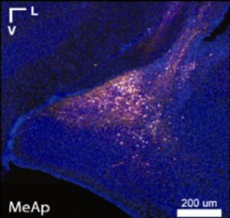Cellular Calcium Imaging