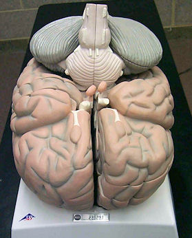 Large Plastic Brain Model